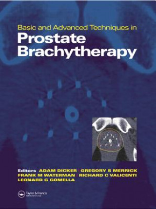Knjiga Basic and Advanced Techniques in Prostate Brachytherapy Adam P. Dicker