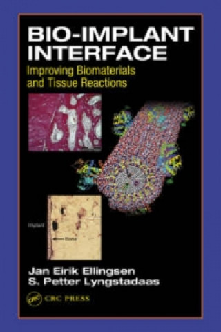 Kniha Bio-Implant Interface S.P. Lyngstadaas