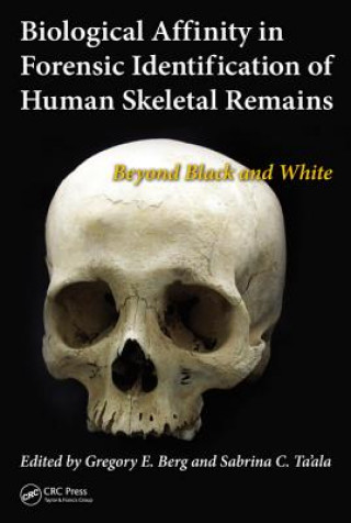 Könyv Biological Affinity in Forensic Identification of Human Skeletal Remains Gregory E. Berg