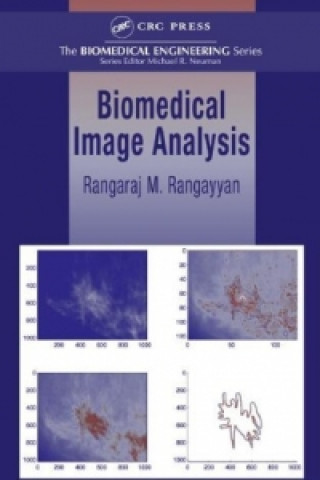 Kniha Biomedical Image Analysis Rangaraj M. Rangayyan