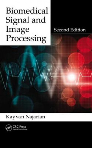 Książka Biomedical Signal and Image Processing Robert Splinter