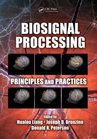 Knjiga Biosignal Processing Joseph D. Bronzino