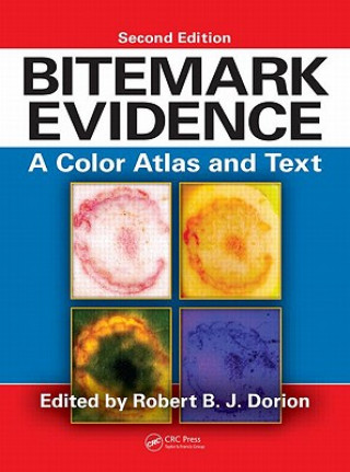 Книга Bitemark Evidence Robert B. J. Dorion