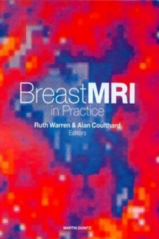 Book Breast MRI in Practice 