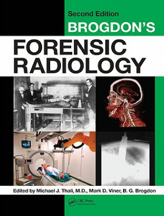 Kniha Brogdon's Forensic Radiology 