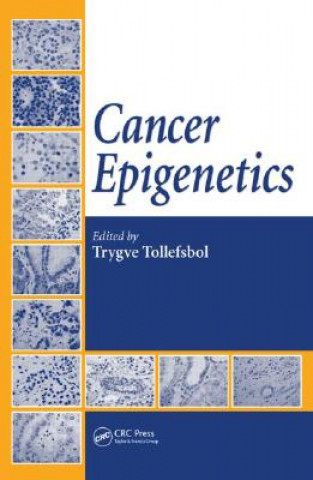 Kniha Cancer Epigenetics Trygve Tollefsbol