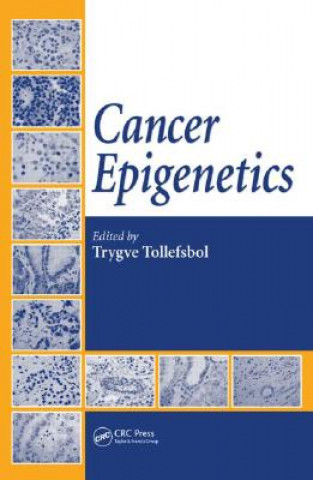 Livre Cancer Epigenetics Trygve Tollefsbol