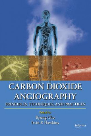 Kniha Carbon Dioxide Angiography 