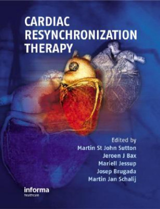 Книга Cardiac Resynchronization Therapy 