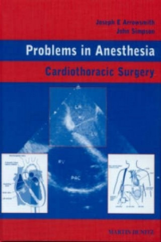 Knjiga Cardiothoracic Surgery John Simpson