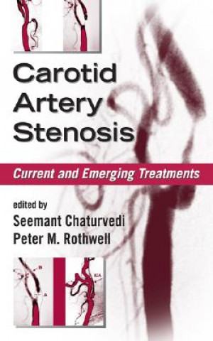 Libro Carotid Artery Stenosis Seemant Chaturvedi