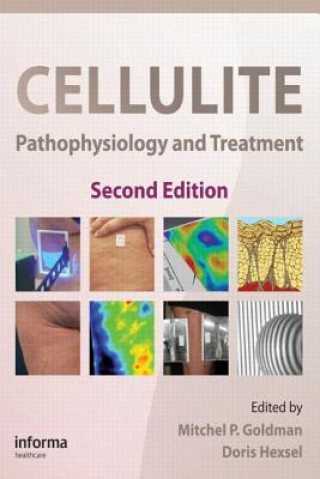 Книга Cellulite 