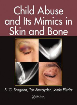 Carte Child Abuse and Its Mimics in Skin and Bone Jamie Elifritz