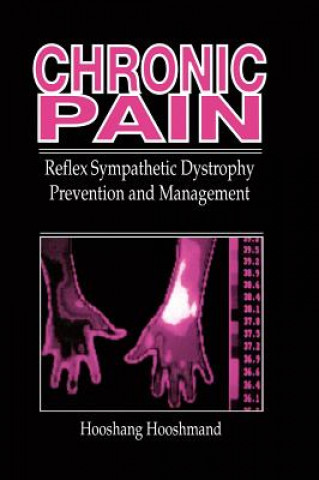 Knjiga Chronic Pain Hooshang Hooshmand