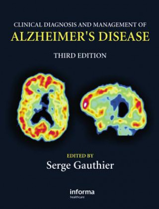 Könyv Clinical Diagnosis and Management of Alzheimer's Disease 