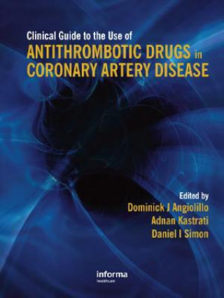 Carte Clinical Guide to the Use of Antithrombotic Drugs in Coronary Artery Disease 