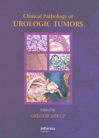 Knjiga Clinical Pathology of Urological Tumours 