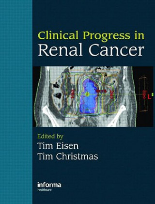 Книга Clinical Progress in Renal Cancer 