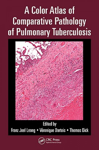 Kniha Color Atlas of Comparative Pathology of Pulmonary Tuberculosis Franz Joel Leong