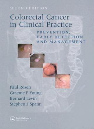 Könyv Colorectal Cancer in Clinical Practice 