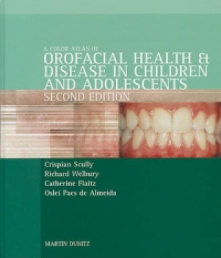 Kniha Color Atlas of Orofacial Health and Disease in Children and Adolescents Oslei Paes de Almeida