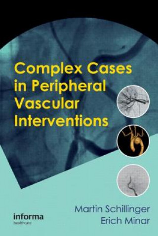 Könyv Complex Cases in Peripheral Vascular Interventions 