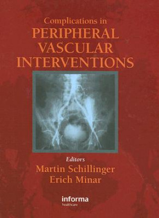 Kniha Complications in Peripheral Vascular Interventions 