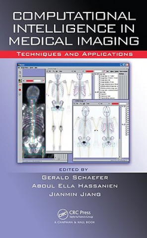 Carte Computational Intelligence in Medical Imaging G. Schaefer