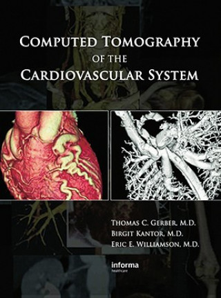 Kniha Computed Tomography of the Cardiovascular System 
