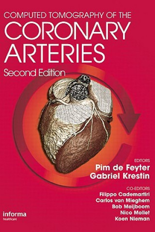 Книга Computed Tomography of the Coronary Arteries Pim J. de Feyter