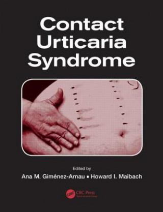 Книга Contact Urticaria Syndrome Ana M. Gimenez-Arnau