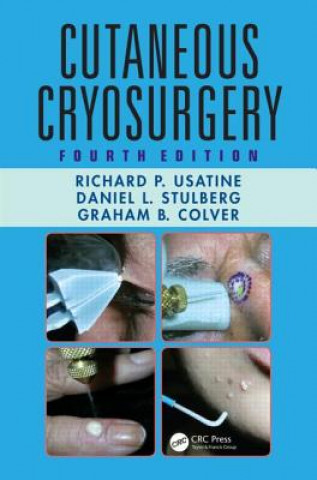 Kniha Cutaneous Cryosurgery Graham B. Colver