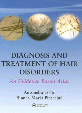 Könyv Diagnosis and Treatment of Hair Disorders Bianca Maria Piraccini