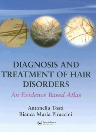 Kniha Diagnosis and Treatment of Hair Disorders Bianca Maria Piraccini