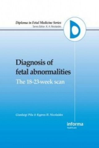 Kniha Diagnosis of Fetal Abnormalities 