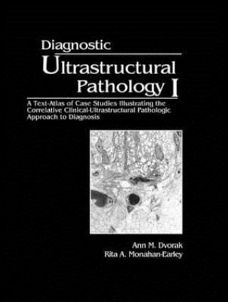 Könyv Diagnostic Ultrastructural Pathology, Volume I Rita A. Monahan-Earley