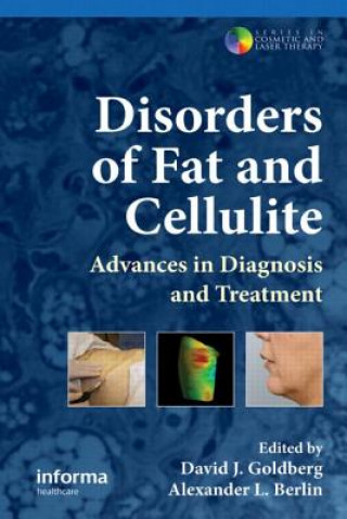 Könyv Disorders of Fat and Cellulite 