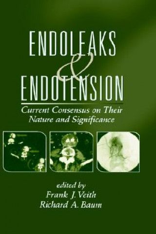 Carte Endoleaks and Endotension 