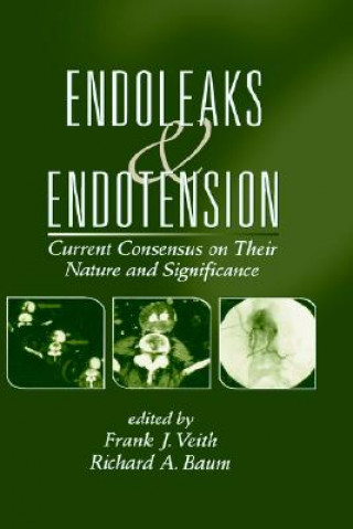 Buch Endoleaks and Endotension 