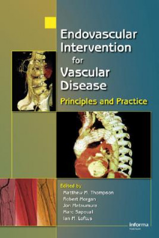 Kniha Endovascular Intervention for Vascular Disease 