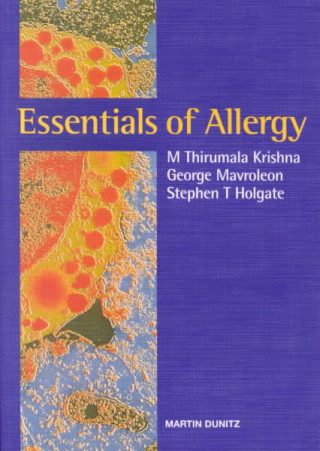 Livre Essentials of Allergy Professor Stephen T. Holgate