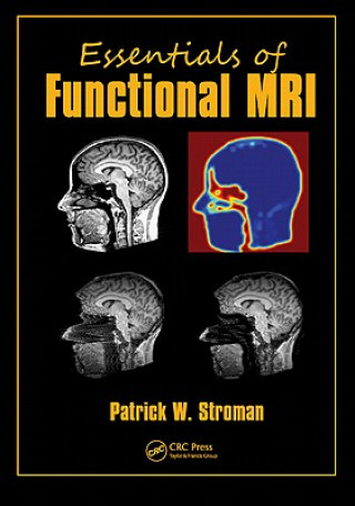 Kniha Essentials of Functional MRI Patrick W. Stroman