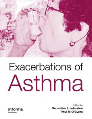 Könyv Exacerbations of Asthma 