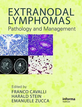 Boek Extranodal Lymphomas Franco Cavalli