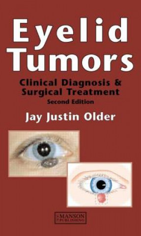 Book Eyelid Tumors Older