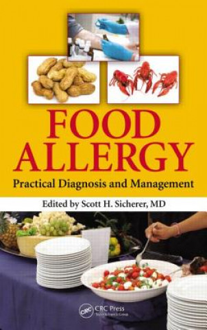 Könyv Food Allergy 