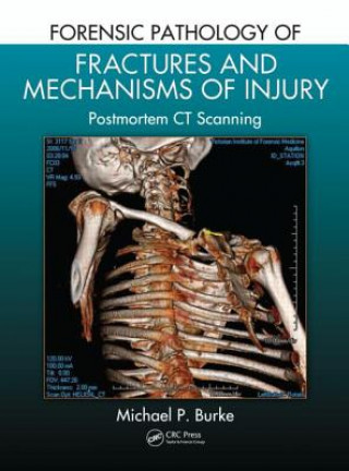 Kniha Forensic Pathology of Fractures and Mechanisms of Injury Michael P. Burke