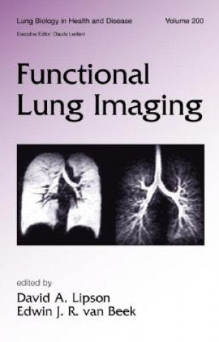 Книга Functional Lung Imaging 