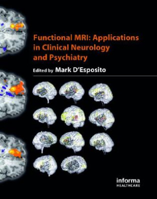 Knjiga Functional MRI Mark D'Esposito