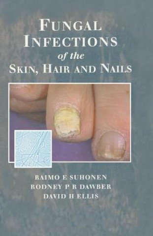 Carte Fungal Infections of the Skin and Nails David H. Ellis